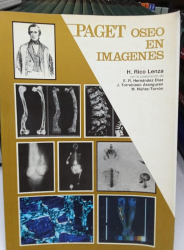 Portada do libro de PAGET OSEO EN IMAGENES - H.RICO LENZA (B)